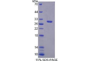 Image no. 1 for Ring Finger Protein 112 (RNF112) (AA 403-647) protein (His tag) (ABIN6237711) (RNF112 Protein (AA 403-647) (His tag))