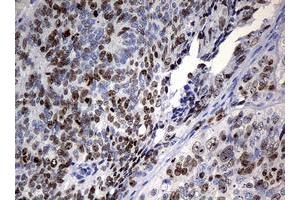 Image no. 2 for anti-Antigen Identified By Monoclonal Antibody Ki-67 (MKI67) (AA 1160-1493) antibody (ABIN1490857) (Ki-67 anticorps  (AA 1160-1493))