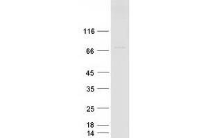 Validation with Western Blot