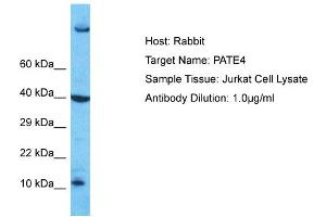 Host: Rabbit Target Name: PATE4 Sample Type: Jurkat Whole Cell lysates Antibody Dilution: 1. (PATE4 anticorps  (Middle Region))