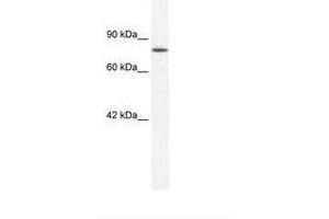 Image no. 1 for anti-Zinc Finger Protein 214 (ZNF214) (AA 37-86) antibody (ABIN202807) (ZNF214 anticorps  (AA 37-86))
