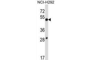 Western Blotting (WB) image for anti-Dual Specificity Phosphatase 9 (DUSP9) antibody (ABIN2997604)
