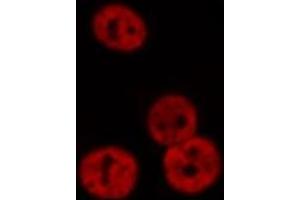 ABIN6276374 staining Hela cells by IF/ICC.
