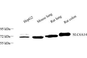 Western blot analysis of SLC6A14 (ABIN7075677) at dilution of 1: 1000