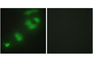 Immunofluorescence analysis of HepG2 cells, using CREBZF Antibody. (CREBZF anticorps  (AA 221-270))