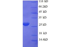 SIVA1, Apoptosis-Inducing Factor (SIVA1) (AA 1-110) protein (His-SUMO Tag)