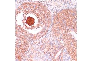 Immunohistochemistry of paraffin-embedded Rat ovary using CDC20 antibody (ABIN7266246) at dilution of 1:100 (40x lens).