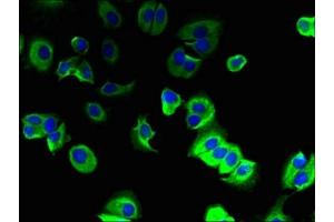 Immunofluorescent analysis of MCF-7 cells using ABIN7173293 at dilution of 1:100 and Alexa Fluor 488-congugated AffiniPure Goat Anti-Rabbit IgG(H+L) (TMEM91 anticorps  (AA 1-97))