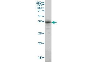 CA8 monoclonal antibody (M01), clone 1F7 Western Blot analysis of CA8 expression in A-549 .