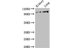 Western Blot Positive WB detected in: Mouse kidney tissue, Rat lung tissue All lanes: VAV3 antibody at 2. (VAV3 anticorps  (AA 562-674))