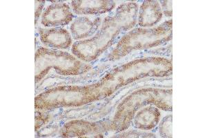 Immunohistochemistry of paraffin-embedded mouse kidney using NDUFB8 Rabbit pAb (ABIN7268814) at dilution of 1:100 (40x lens).