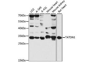Western blot analysis of extracts of various cell lines, using TATDN1 antibody (ABIN6293775) at 1:3000 dilution.