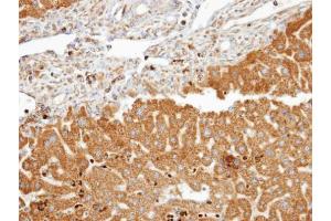 IHC-P Image Immunohistochemical analysis of paraffin-embedded human liver, using FDFT1, antibody at 1:100 dilution. (FDFT1 anticorps)