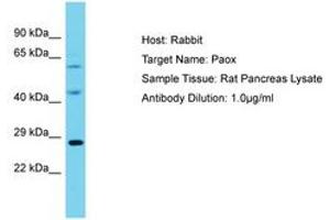 Image no. 1 for anti-Polyamine Oxidase (Exo-N4-Amino) (PAOX) (AA 101-150) antibody (ABIN6750341) (PAOX anticorps  (AA 101-150))