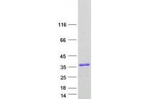 Validation with Western Blot