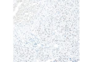Immunohistochemistry (IHC) image for anti-Regulatory Factor X, 1 (Influences HLA Class II Expression) (RFX1) (AA 929-979) antibody (ABIN7454894)