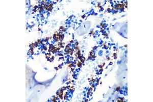 Immunohistochemistry of paraffin-embedded mouse bone marrow using S100 Rabbit mAb (ABIN7270128) at dilution of 1:100 (40x lens). (S100A8 anticorps)