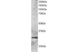 Western Blotting (WB) image for anti-SYF2 Homolog, RNA Splicing Factor (SYF2) antibody (ABIN5920069) (SYF2 anticorps)