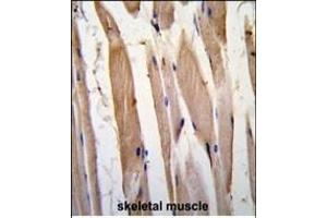 Formalin-fixed and paraffin-embedded human skeletal muscle tissue reacted with VINC antibody (N-term) , which was peroxidase-conjugated to the secondary antibody, followed by DAB staining. (Vinculin anticorps  (N-Term))