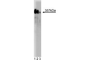 Western Blotting (WB) image for anti-Centromere Protein F (CENPF) (AA 209-381) antibody (ABIN968167) (CENPF anticorps  (AA 209-381))