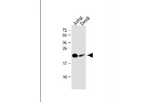 All lanes : Anti-NCR3 Antibody (N-Term) at 1:1000 dilution Lane 1: Jurkat whole cell lysate Lane 2: Daudi whole cell lysate Lysates/proteins at 20 μg per lane. (NCR3 anticorps  (AA 31-65))
