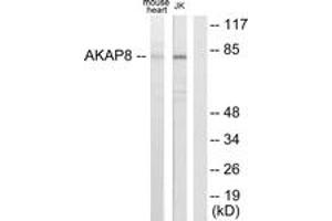 Western blot analysis of extracts from mouse heart/Jurkat cells, using AKAP8 Antibody. (AKAP8 anticorps  (AA 331-380))