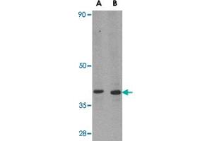 Western blot analysis of DHX58 in MDA-MB-361 cell lysate with DHX58 polyclonal antibody  at (A) 0. (DHX58 anticorps  (N-Term))