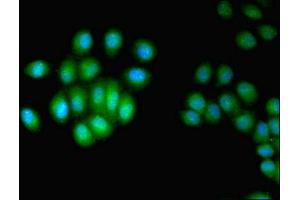 Immunofluorescent analysis of A549 cells using ABIN7147541 at dilution of 1:100 and Alexa Fluor 488-congugated AffiniPure Goat Anti-Rabbit IgG(H+L) (HUS1 anticorps  (AA 2-280))