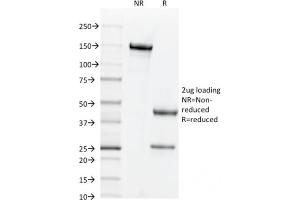 SDS-PAGE Analysis Purified CD44v6 Mouse Monoclonal Antibody (2F10). (CD44 anticorps)