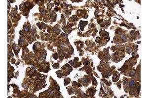 Image no. 4 for anti-TAP Binding Protein-Like (TAPBPL) antibody (ABIN1501302)