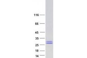 Validation with Western Blot