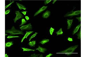 Immunofluorescence of monoclonal antibody to TUBA4A on HeLa cell. (TUBA4A anticorps  (AA 1-448))