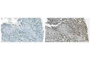 IHC analysis of GRSF1 using anti-GRSF1 antibody (ABIN7599803). (GRSF1 anticorps  (AA 119-405))