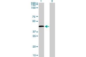 Western Blot analysis of C5R1 expression in transfected 293T cell line by C5R1 monoclonal antibody (M02), clone 4E2.
