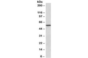 Western blot testing of human kidney lysate with Epoxide hydrolase 2 antibody at 0. (EPHX2 anticorps)
