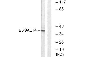 Western blot analysis of extracts from Jurkat cells, using B3GALT4 antibody. (B3GALT4 anticorps)