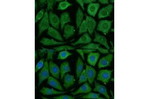 Immunofluorescence analysis of L929 cells using SARDH Polyclonal Antibody (ABIN6128753, ABIN6147379, ABIN6147380 and ABIN6225034) at dilution of 1:100 (40x lens). (SARDH anticorps  (AA 300-560))
