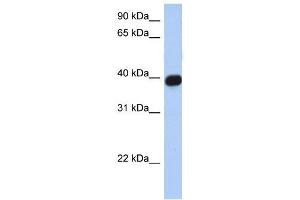 CXCR6 antibody (70R-10500) used at 0. (CXCR6 anticorps  (N-Term))