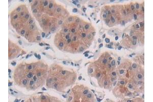 Detection of IL10 in Human Stomach Tissue using Polyclonal Antibody to Interleukin 10 (IL10) (IL-10 anticorps  (AA 19-178))