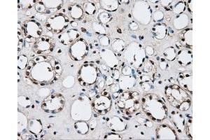 Immunohistochemical staining of paraffin-embedded liver tissue using anti-PLEKmouse monoclonal antibody. (Pleckstrin anticorps)