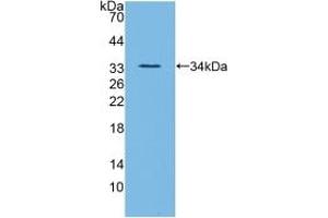 Detection of Recombinant ANGPTL3, Mouse using Polyclonal Antibody to Angiopoietin Like Protein 3 (ANGPTL3)
