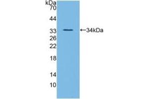 Detection of Recombinant ANGPTL3, Mouse using Polyclonal Antibody to Angiopoietin Like Protein 3 (ANGPTL3) (ANGPTL3 anticorps  (AA 22-281))