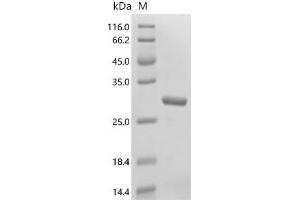 (Tris-Glycine gel) Discontinuous SDS-PAGE (reduced) with 5 % enrichment gel and 15 % separation gel.
