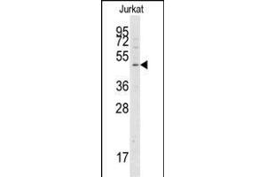 Western blot analysis of anti-G4A Pab 1808c in Jurkat cell line lysates (35 μg/lane). (ATG4A anticorps  (AA 363-392))