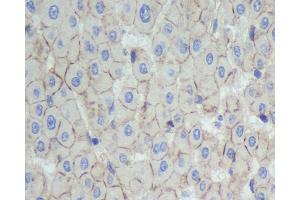 Immunohistochemistry analysis of paraffin-embedded human liver using N-cadherin Polyclonal Antibody at dilution of 1:500. (N-Cadherin anticorps)