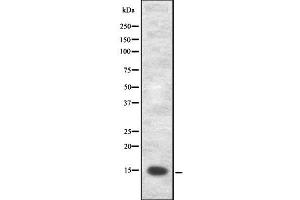Western blot analysis of VAMP8 using A549 whole  lysates. (VAMP8 anticorps  (Internal Region))