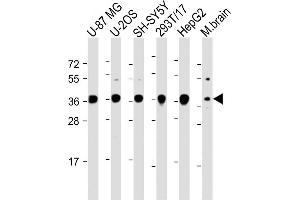 All lanes : Anti-EN1 (Engrailed 1) Antibody (N-term) at 1:2000 dilution Lane 1: U-87 MG whole cell lysate Lane 2: U-2OS whole cell lysate Lane 3: SH-SY5Y whole cell lysate Lane 4: 293T/17 whole cell lysate Lane 5: HepG2 whole cell lysate Lane 6: Mouse brain lysate Lysates/proteins at 20 μg per lane. (EN1 anticorps  (N-Term))