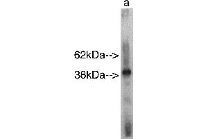 Western blot analysis using Sphingomyelin Synthase r  on recombinant protein Lane A] antibody alone. (SAMD8 anticorps)