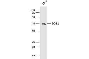 Mouse Liver lysates probed with DDB2 Polyclonal Antibody, Unconjugated  at 1:500 dilution and 4˚C overnight incubation.