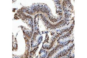 IHC analysis of PCNA using anti-PCNA antibody (ABIN7599179).